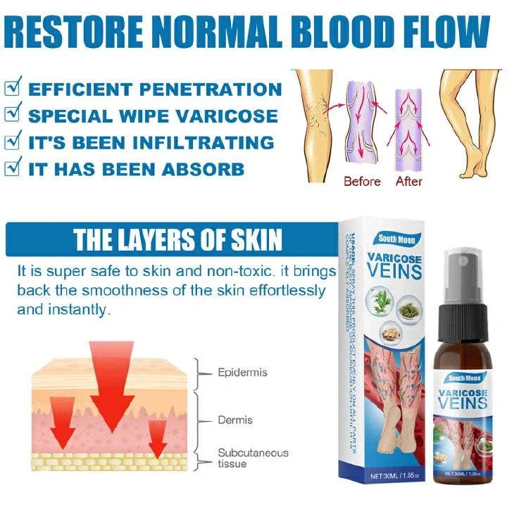 Tratamiento en Spray Varicose Veins + ENVIO GRATIS