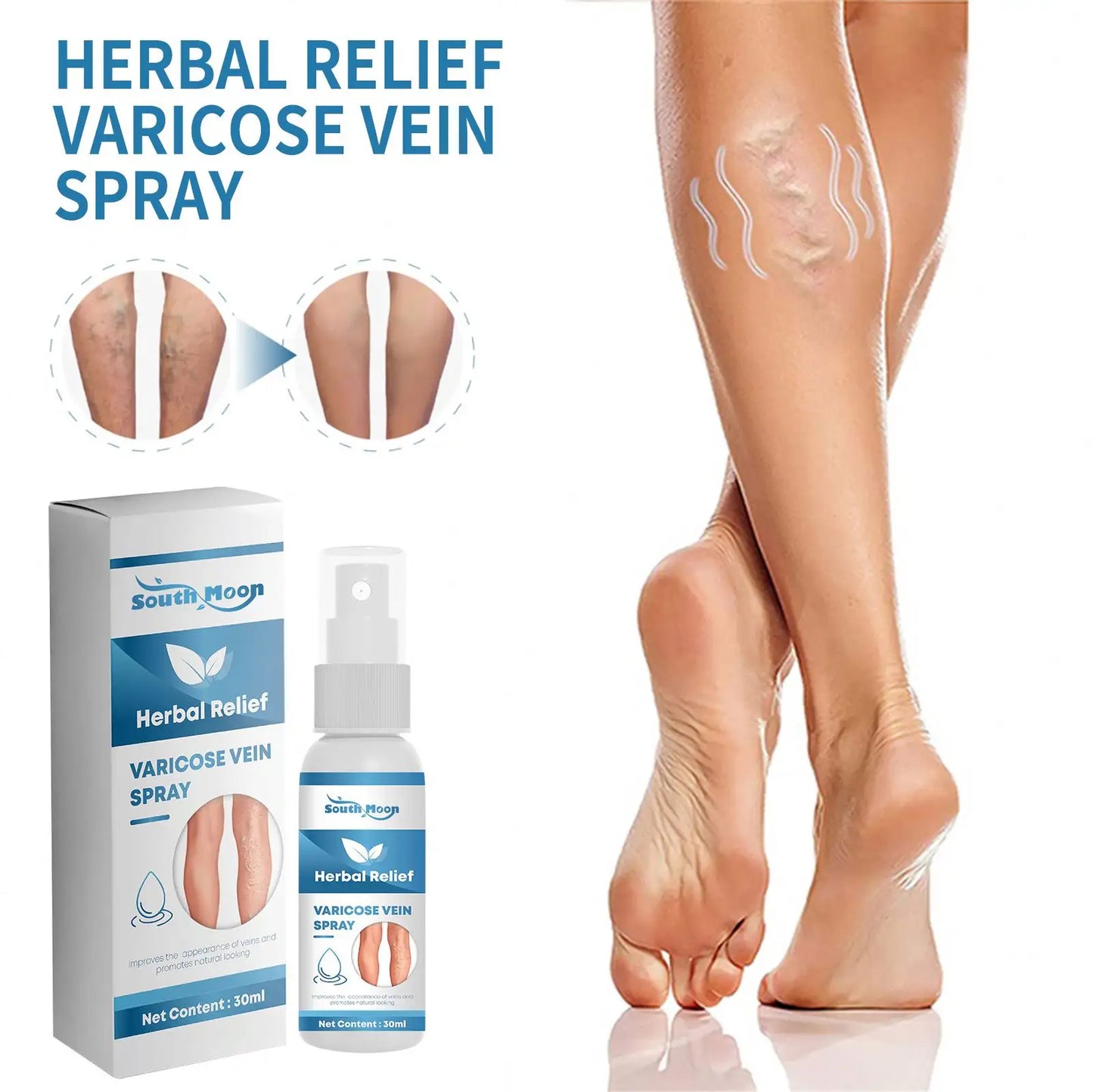 Tratamiento en Spray Varicose Veins + ENVIO GRATIS