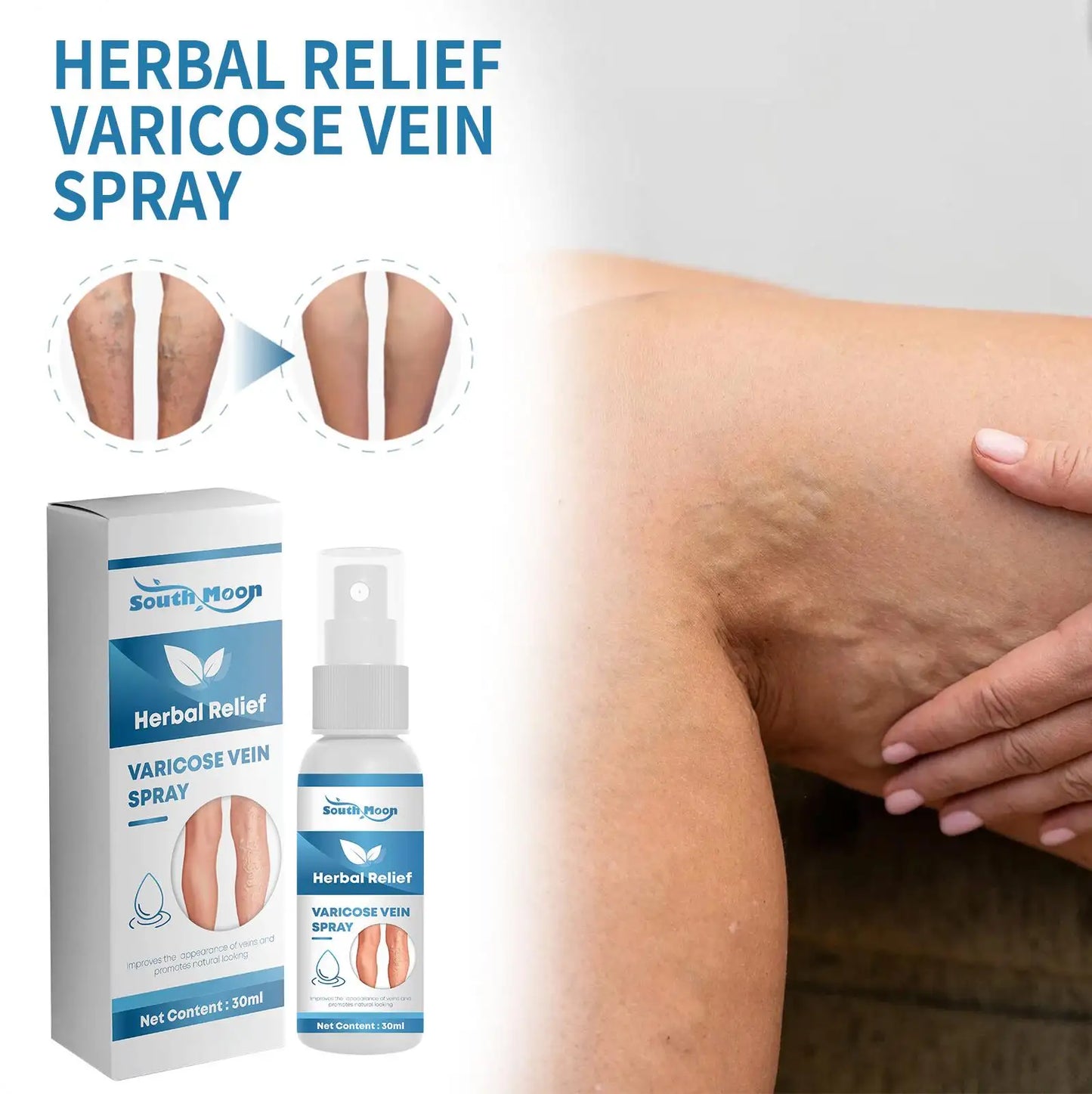 Tratamiento en Spray Varicose Veins + ENVIO GRATIS
