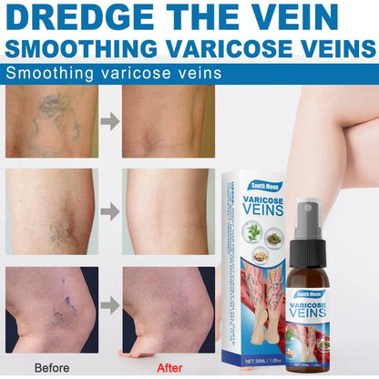 Tratamiento en Spray Varicose Veins + ENVIO GRATIS