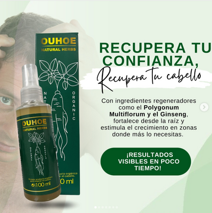 🔥Elimina La Caída Del Cabello: GOTAS OUHUE 😍+ ENVÍO GRATIS 🚚