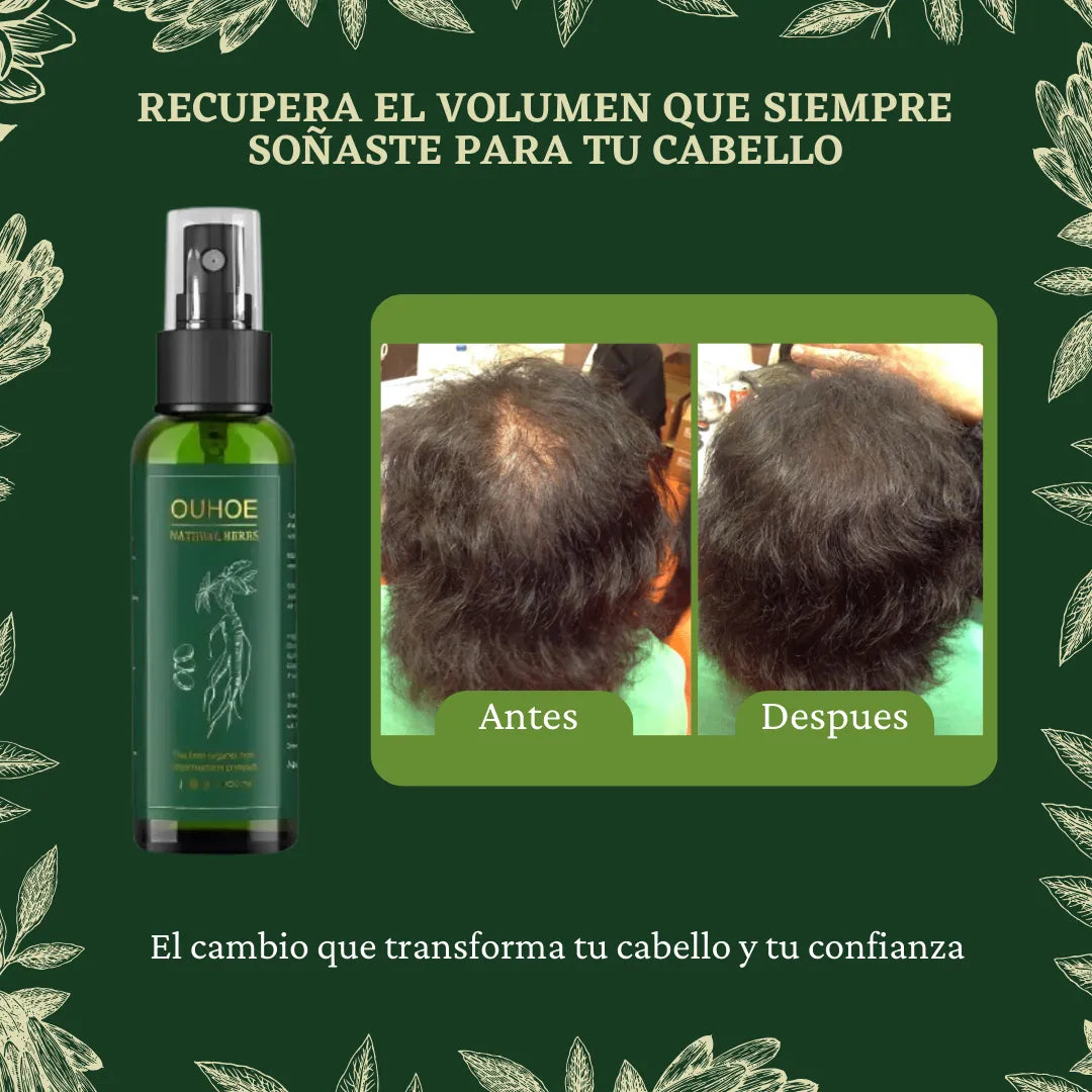 🔥Elimina La Caída Del Cabello: GOTAS OUHUE 😍+ ENVÍO GRATIS 🚚