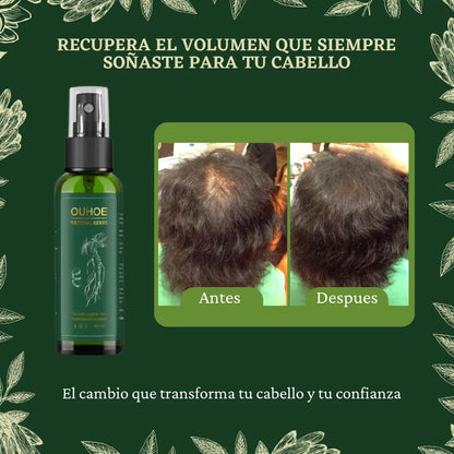 🔥Elimina La Caída Del Cabello: GOTAS OUHUE 😍+ ENVÍO GRATIS 🚚