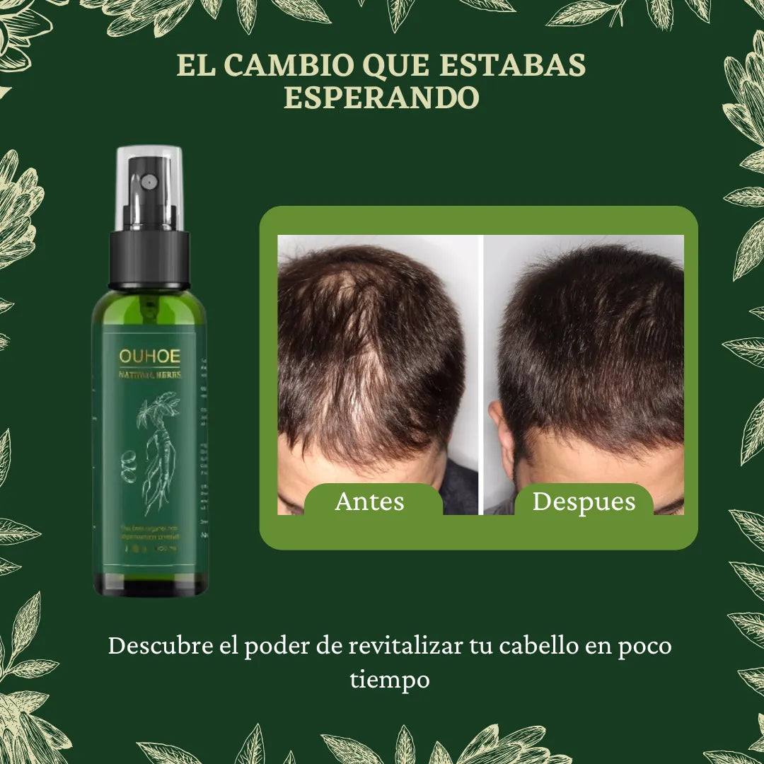 🔥Elimina La Caída Del Cabello: GOTAS OUHUE 😍+ ENVÍO GRATIS 🚚