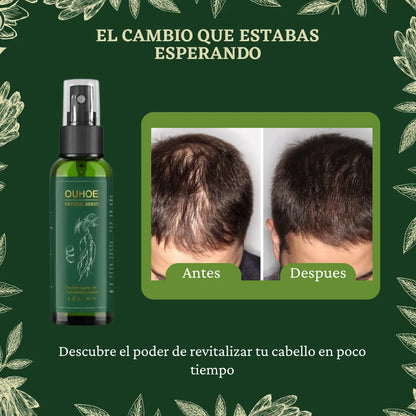 🔥Elimina La Caída Del Cabello: GOTAS OUHUE 😍+ ENVÍO GRATIS 🚚