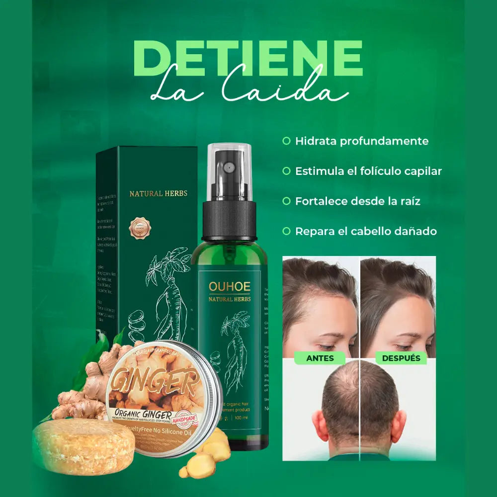 🔥Elimina La Caída Del Cabello: GOTAS OUHUE 😍+ ENVÍO GRATIS 🚚