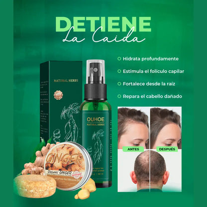 🔥Elimina La Caída Del Cabello: GOTAS OUHUE 😍+ ENVÍO GRATIS 🚚