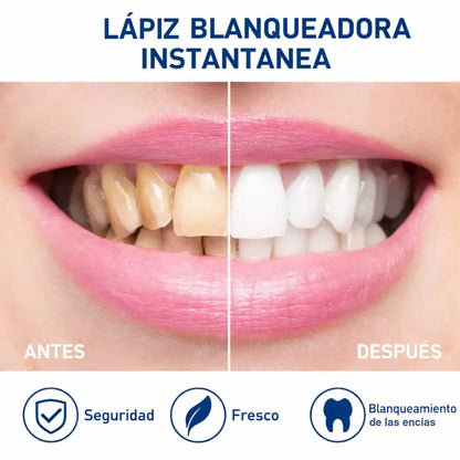 Lápiz Blanqueador Dental Pro Dazzling White + ENVÍO GRATIS 🚚